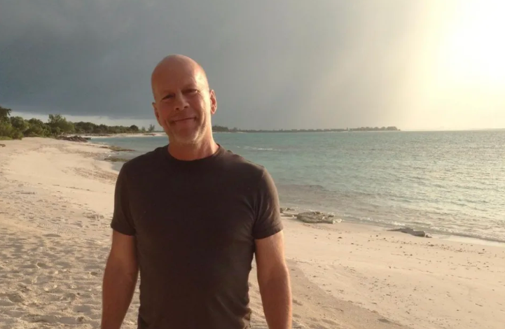 额颞叶失智症,布鲁斯威利