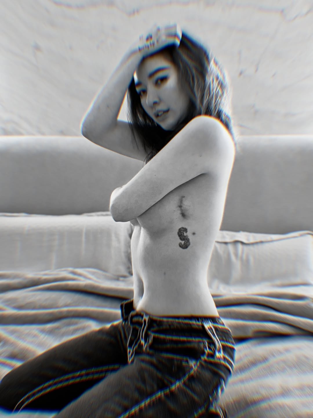 许维恩,罹癌, 罹癌双乳,蟹足肿疤痕