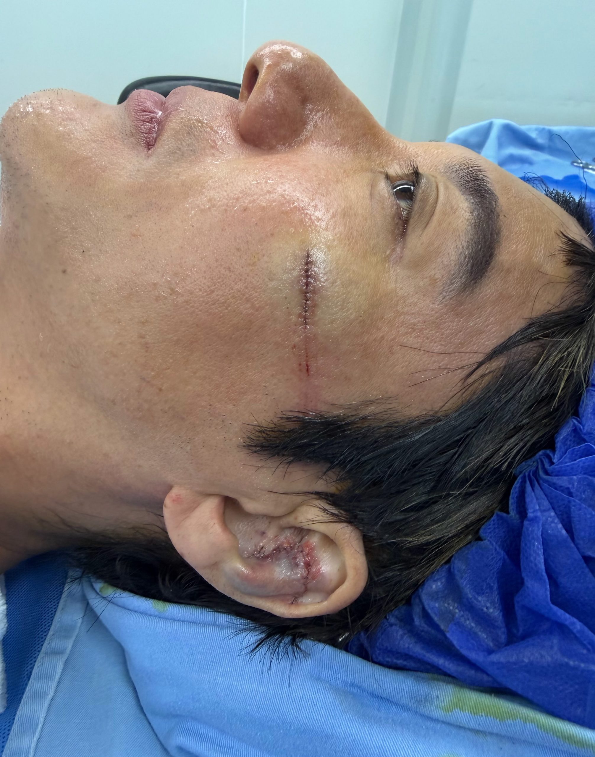 王力宏重摔